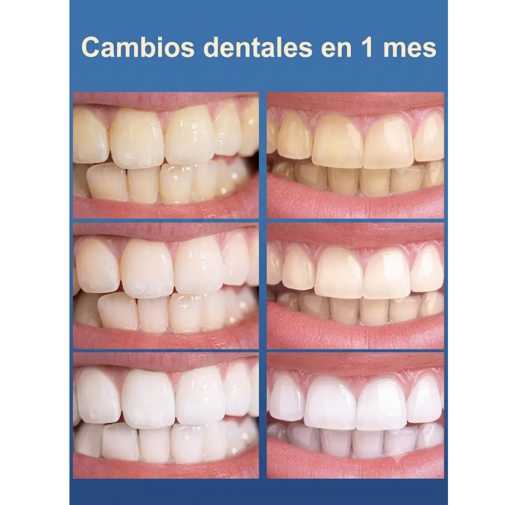 teeth whitening blanqueador dental
